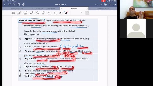 HORMONES 4TH LECTURE HYPOTHYROIDISM