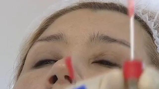 Дмитрий Гаврин - Плазмолифтинг смотреть онлайн