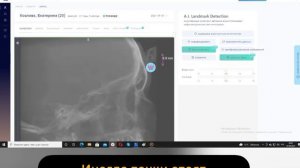 Расчёт трг вырез трг из кт webceph