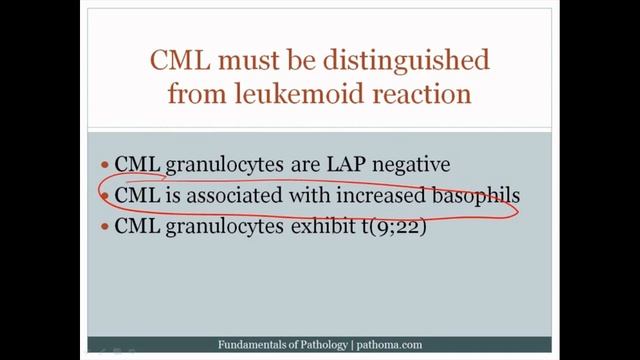 Pathoma USMLE - VI ГЛАВА - 4.Миелопролиферативные заболевания (МПЗ)