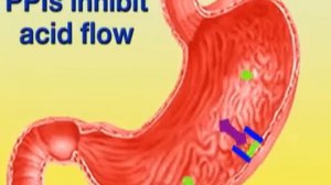 Esomeprazole (Nexium)