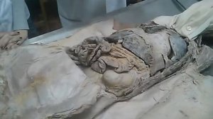 Брюшина. Peritoneum. анатомия часть 1