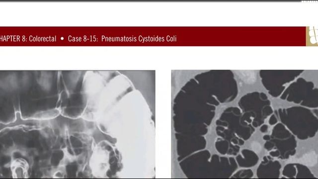 GIT MC GRAW HILL RADIOLOGY BOOKS FRCR(5) смотреть онлайн