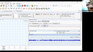 Практикум по ЭМГ: СРВ моторная и сенсорная, F-волна, ритмическая стимуляция | Вебинар Нейрософт