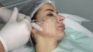 RRS LONG LASTING - 2 ways how to inject depending on the indications