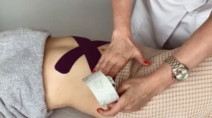Тейпрование для укрепления мышц живота