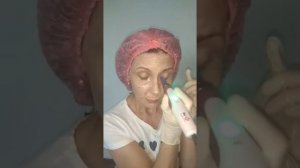 Выравниваем цвет лица в домашних условиях