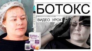 Ботокс видео урок - подсчет единиц, определение зон введения препарата.