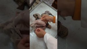 Анатомия семенника
