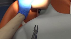 Удаление зуба/Пломбирование полости зуба