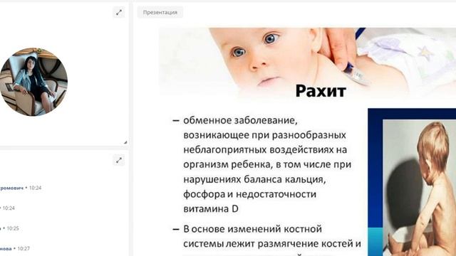 Дети рахитики как выглядят Роль кальция в организме человека - Кристина Варданян.mp4 - смотреть видео онлай