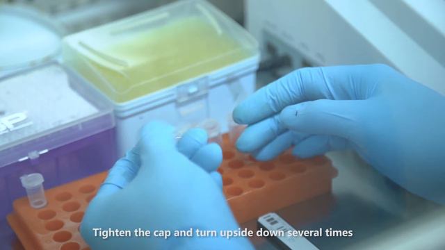 SOP of Finecare™ 2019-nCoV  IgM/IgG Test (Fluorescence Immunoassay) смотреть онлайн