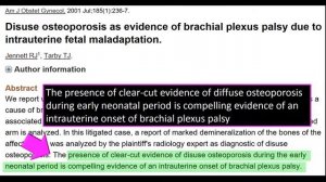 Causes of Brachial Plexus