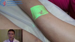 Склеротерапия косметических вен