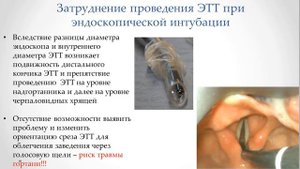 Интубация трахеи: комбинация видеоларингоскопа и гибкого интубационного видеоэндоскопа
