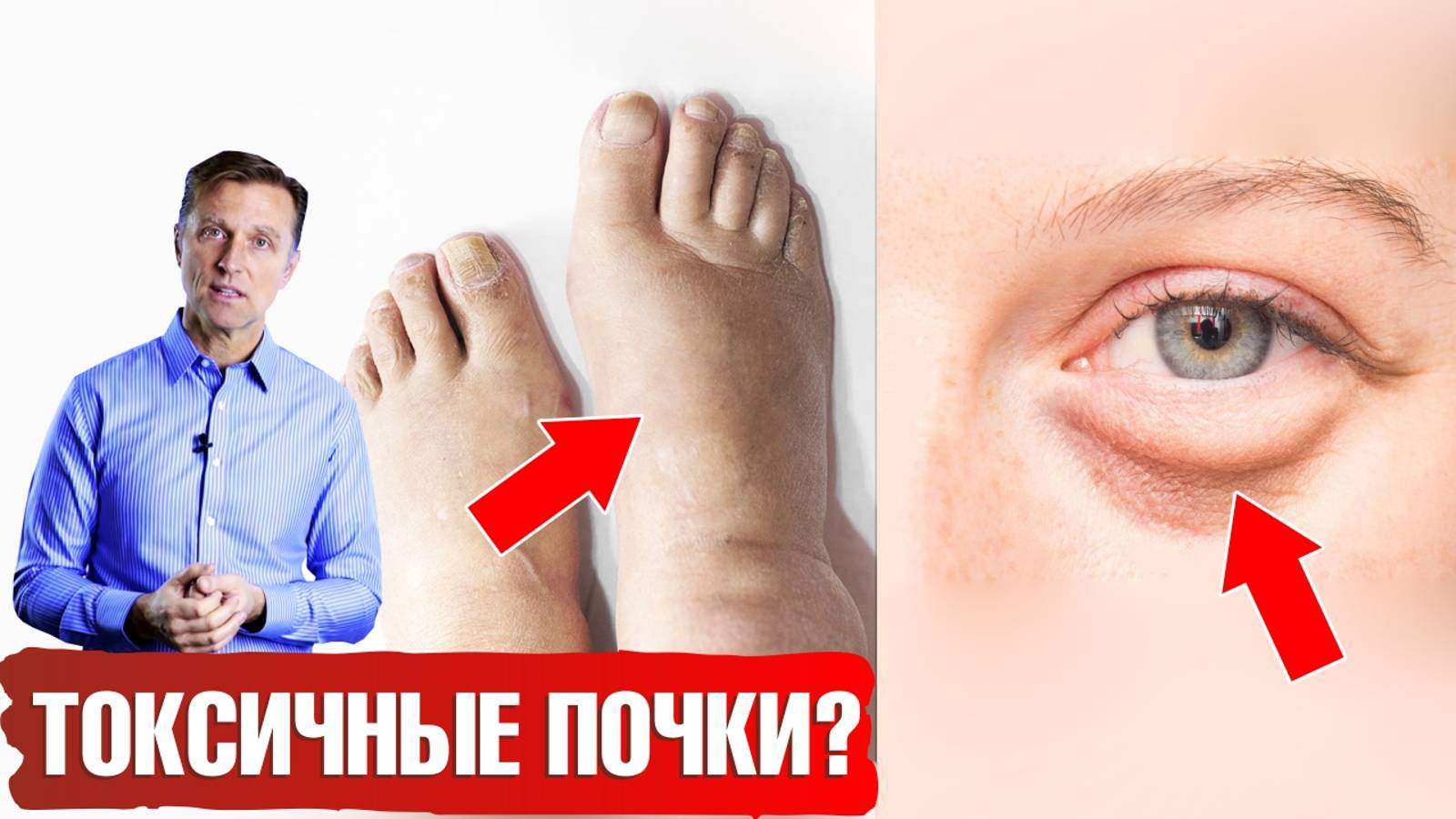 Болезни почек 👉 7 признаков. Лучшие и худшие продукты для почек