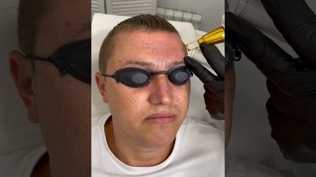 Удаление последствий салюта, фейерверка, пиротехники смотреть онлайн