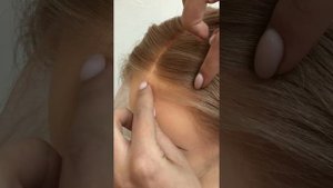 Нужно ли брить голову при установке системы волос? Система волос Divo Krasa