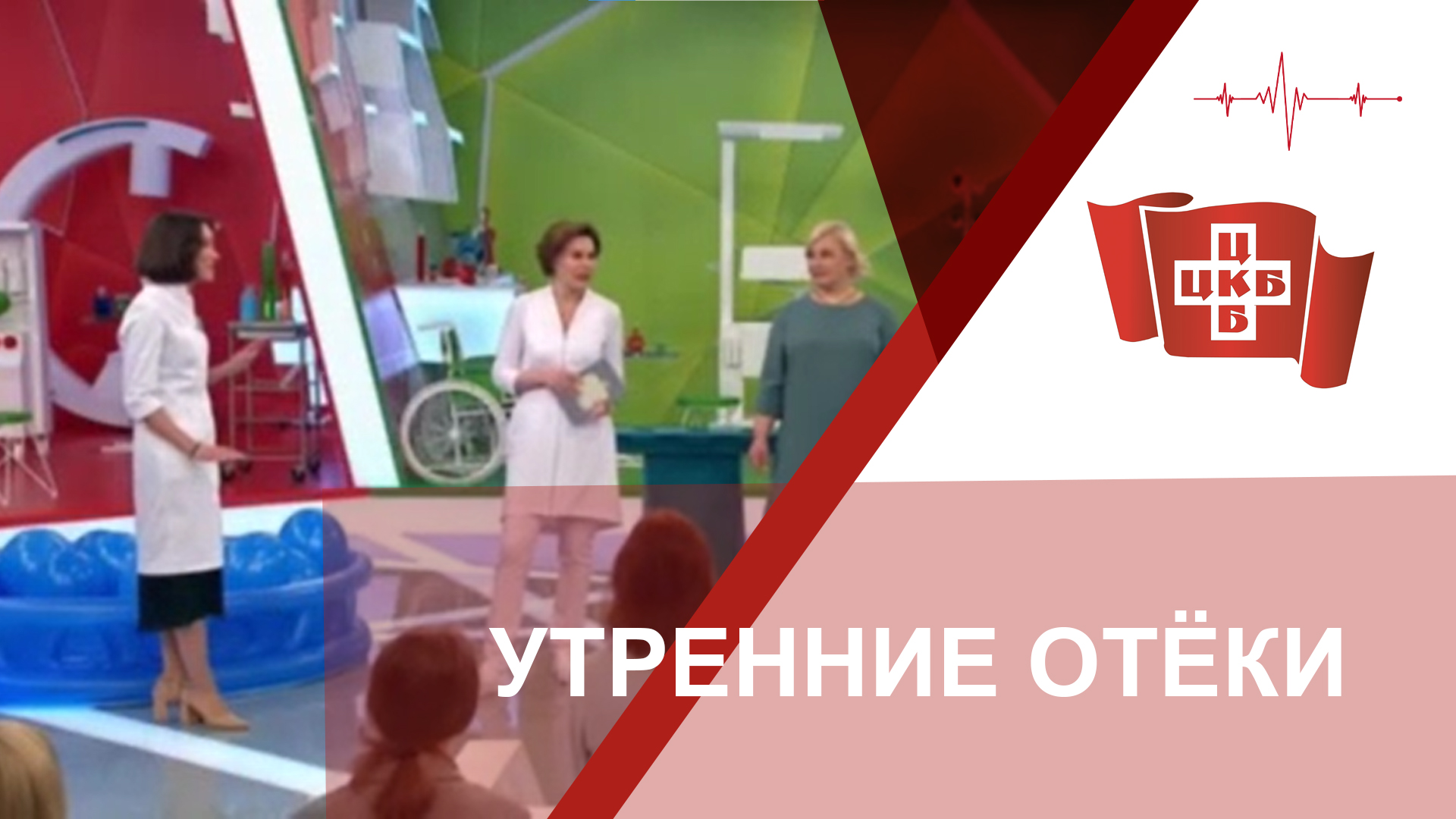 Утренние отеки