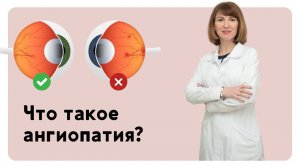 Что такое ангиопатия сетчатки глаза?