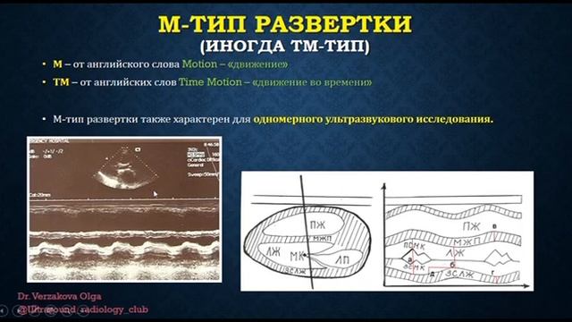 Ультразвуковая диагностика (УЗИ). Методы лучевой диагностики. Часть 4