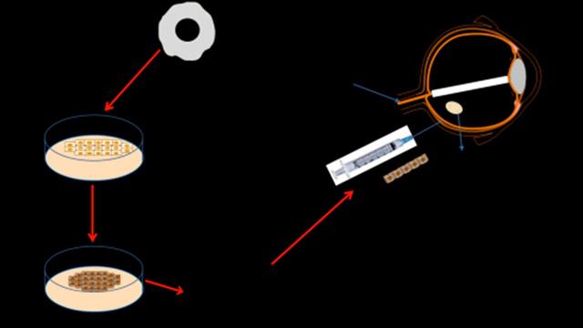 Проблемы с глазами Лучшие варианты лечения смотреть онлайн