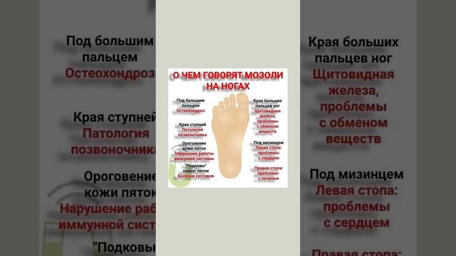 Полезно знать про мозоли на ногах  #полезныесоветы #полезнознать #польза #здоровье