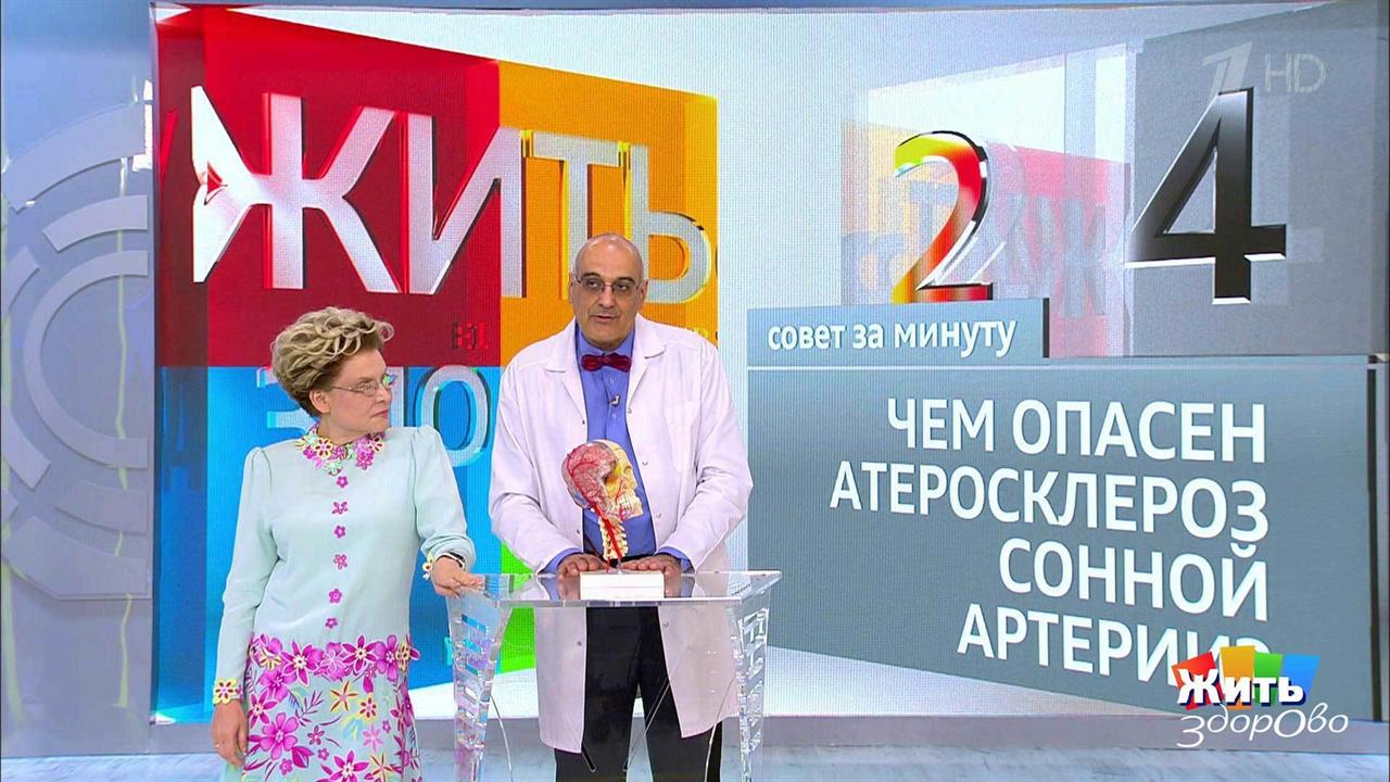 Совет за минуту: атеросклероз сонной артерии. Жить здорово! Фрагмент выпуска от 15.08.2018