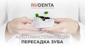 Сам себе донор: аутотрансплантация зуба