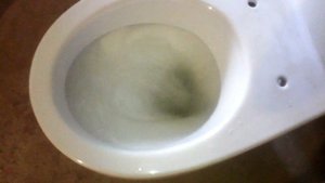 Унитаз Сантек Анимо