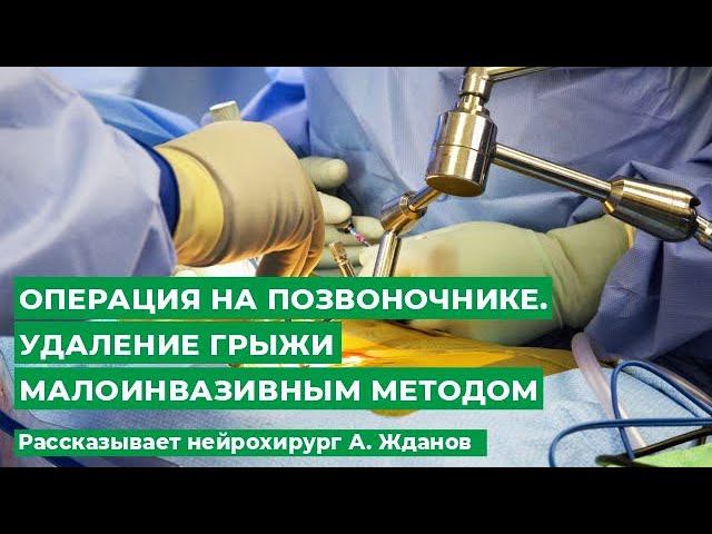 Операция на позвоночнике. Удаление грыжи малоинвазивным методом. Рассказывает нейрохирург А. Жданов