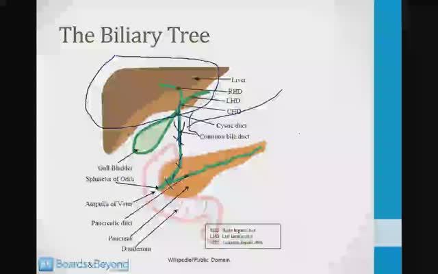 Гастроэнтерология USMLE - 3. Клиническая гастроэнтерология - 7.Заболевания желчевыводящих путей