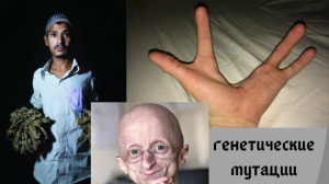 Генетические мутации