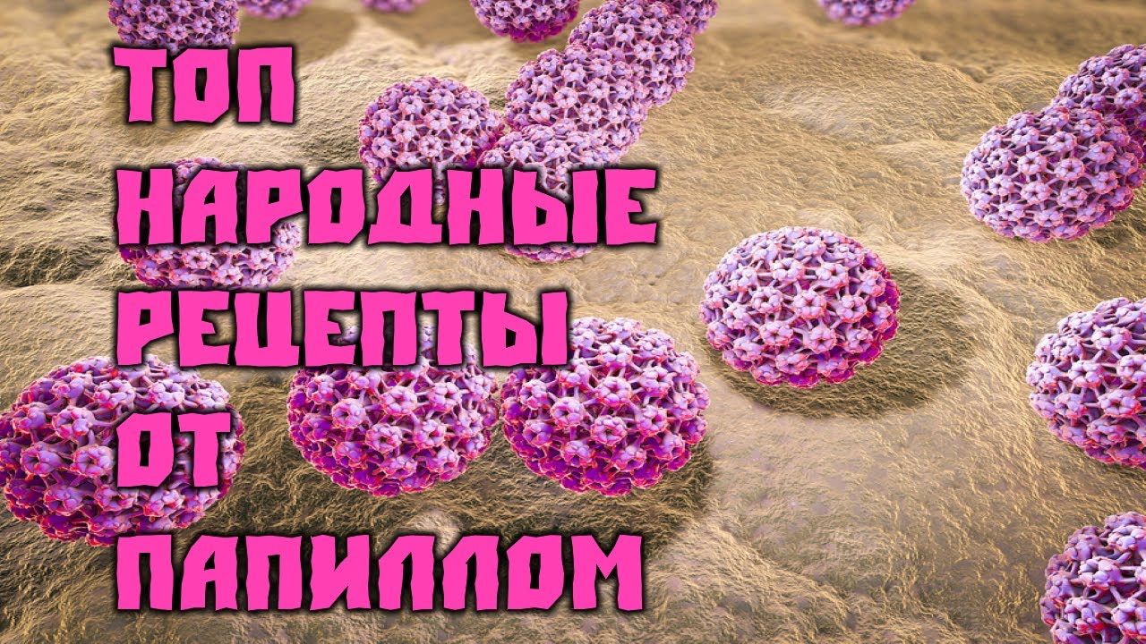 Папилломы Народные Рецепты ТОП смотреть онлайн