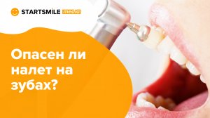 Налет на зубах | Причины и способы лечения