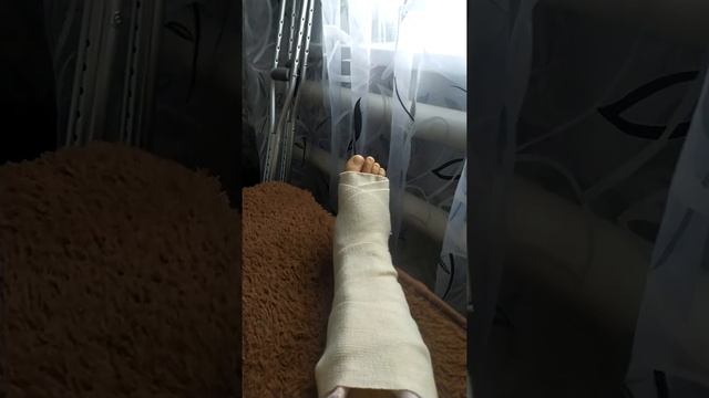 Перелом лодыжки смотреть онлайн
