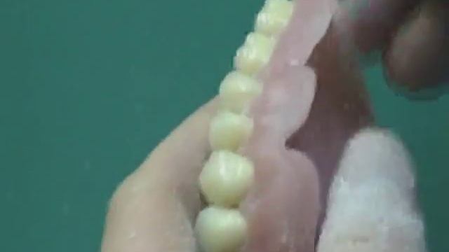 Ссъемные протезы из акрила смотреть онлайн