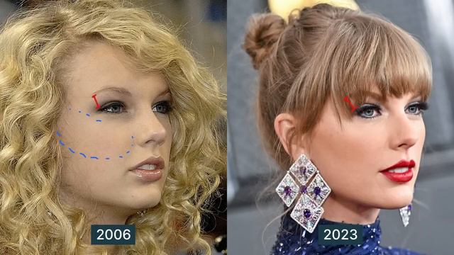 TAYLOR SWIFT – die LIPPEN, die alle wollen💋 – doc.rolf reagiert