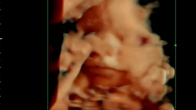 Улыбка дочери во время УЗИ ? смотреть онлайн