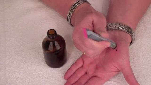 Как свести бородавку в домашних условиях смотреть онлайн