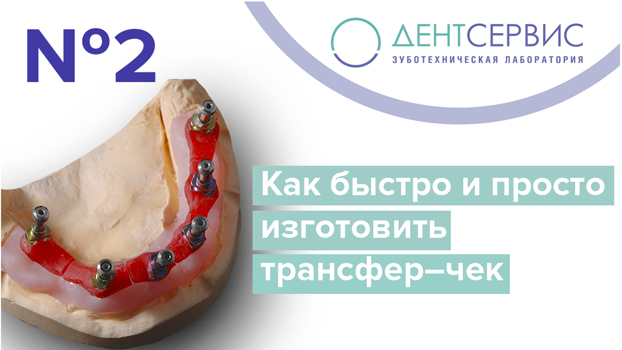 Трансфер–чек: быстро и просто