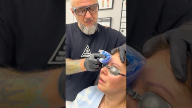 Мастер филигранно удаляет татуаж бровей лазером ⚡ ? #рекомендации  #tattoo #удалениетату #спб #топ