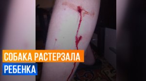 Хозяйская собака напала и растерзала ребенка