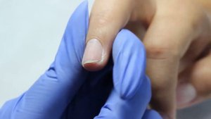 Захват пальца