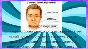 9 симптомов, которые указывают на то, что у вас был микроинсульт, и что вскоре может быть следующий
