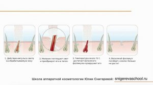 Урок  Фотоэпиляция