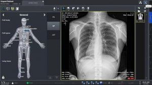 VXvue Quick Guide 02. X-ray Exposure