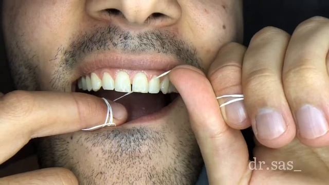 Как правильно пользоваться зубной нитью(флоссом)! смотреть онлайн