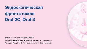 Эндоскопическая фронтотомия Draf 2C, Draf 3. Выполняет Аркадий Николаевич Науменко