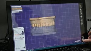 Интраоральный (внутриротовой) 3D-сканер